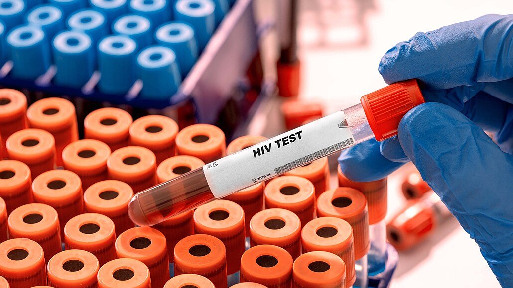 HIV v Česku dál přibývá. Případy nejsou jen ve velkých městech, týkají se i Vysočiny