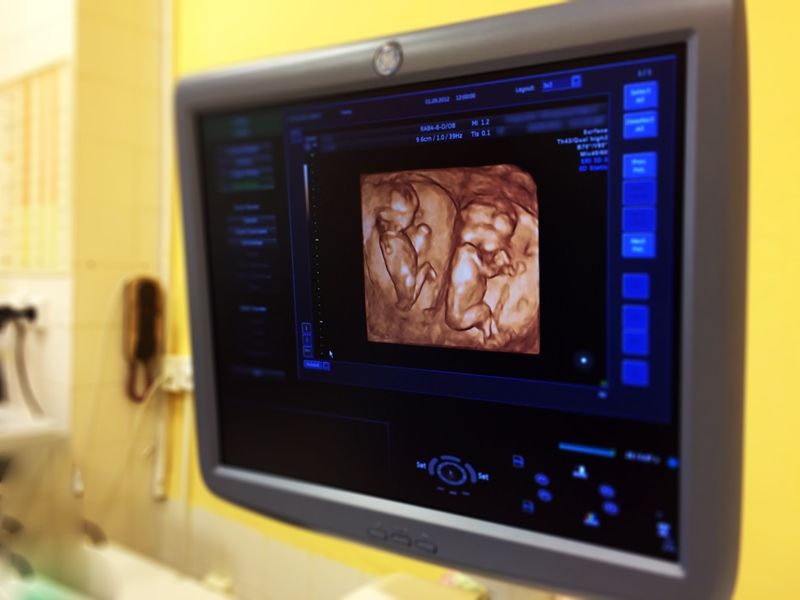 obrázek: Maminky si nově mohou z jihlavské nemocnice domů odnést video i fotky miminka z ultrazvuku