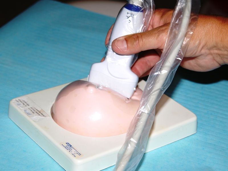 Nové ultrazvuky urychlí a usnadní v jihlavská nemocnici diagnostiku