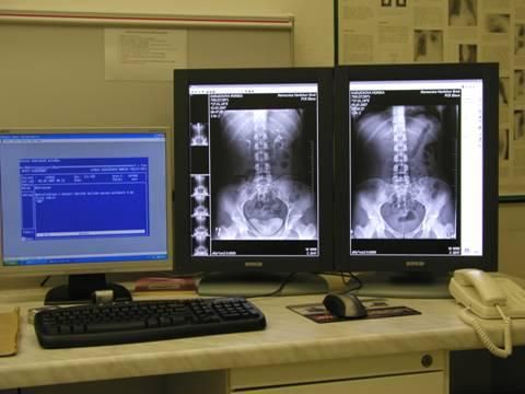 obrázek: Novinka v brodské nemocnici