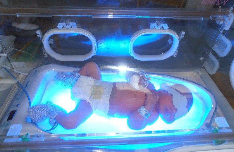 obrázek: Nový přístroj pomůže v jihlavské nemocnici proti žloutence