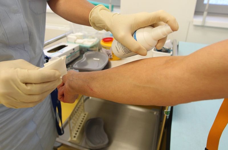 Pozor na včely, přibývá bodnutí, zaznamenali v jihlavské nemocnici