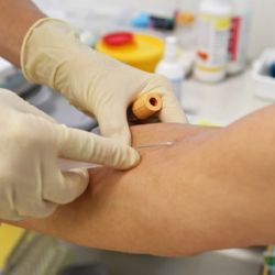 Zdravotníci poradí s pokousáním od psa i netopýra